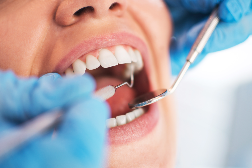 Preventing Gum Disease- Best Practices and Daily Habits