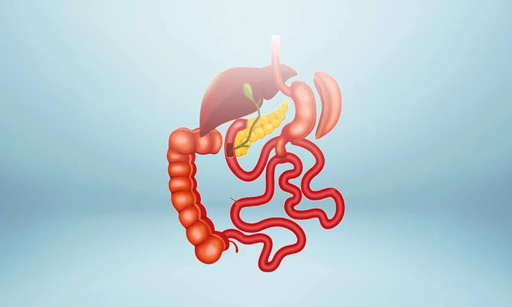 Duodenal Switch Surgery Explained: Everything You Need to Know